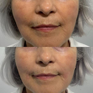 Slider image (6) Dra. Valentina Robledo